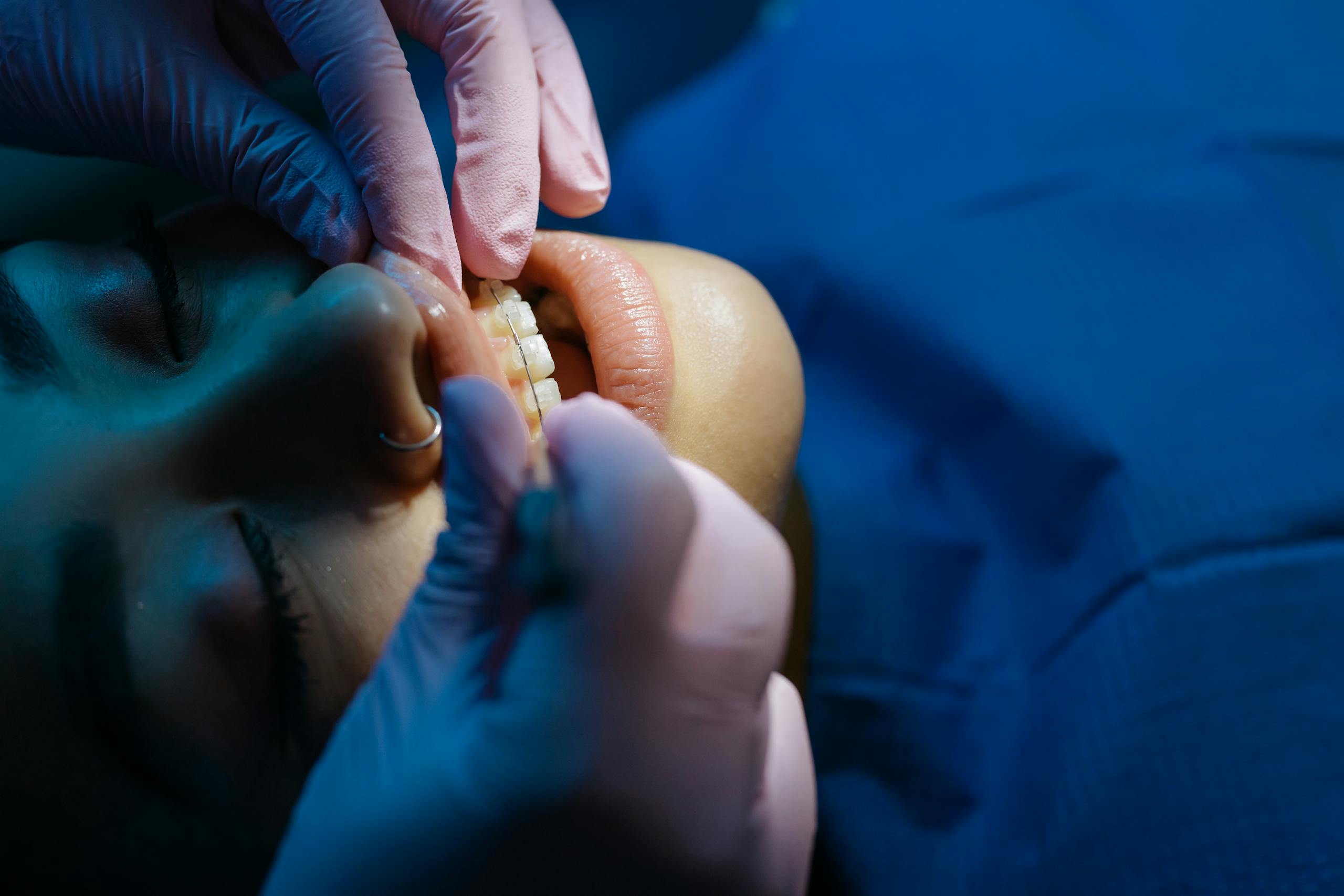 A dentist examines a patient's teeth during a dental procedure under bright clinic lights.